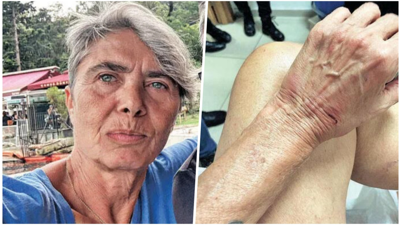 Oyuncu Aslı Altan'ın olaylı gecesi! Darp edildi, gözaltına alındı