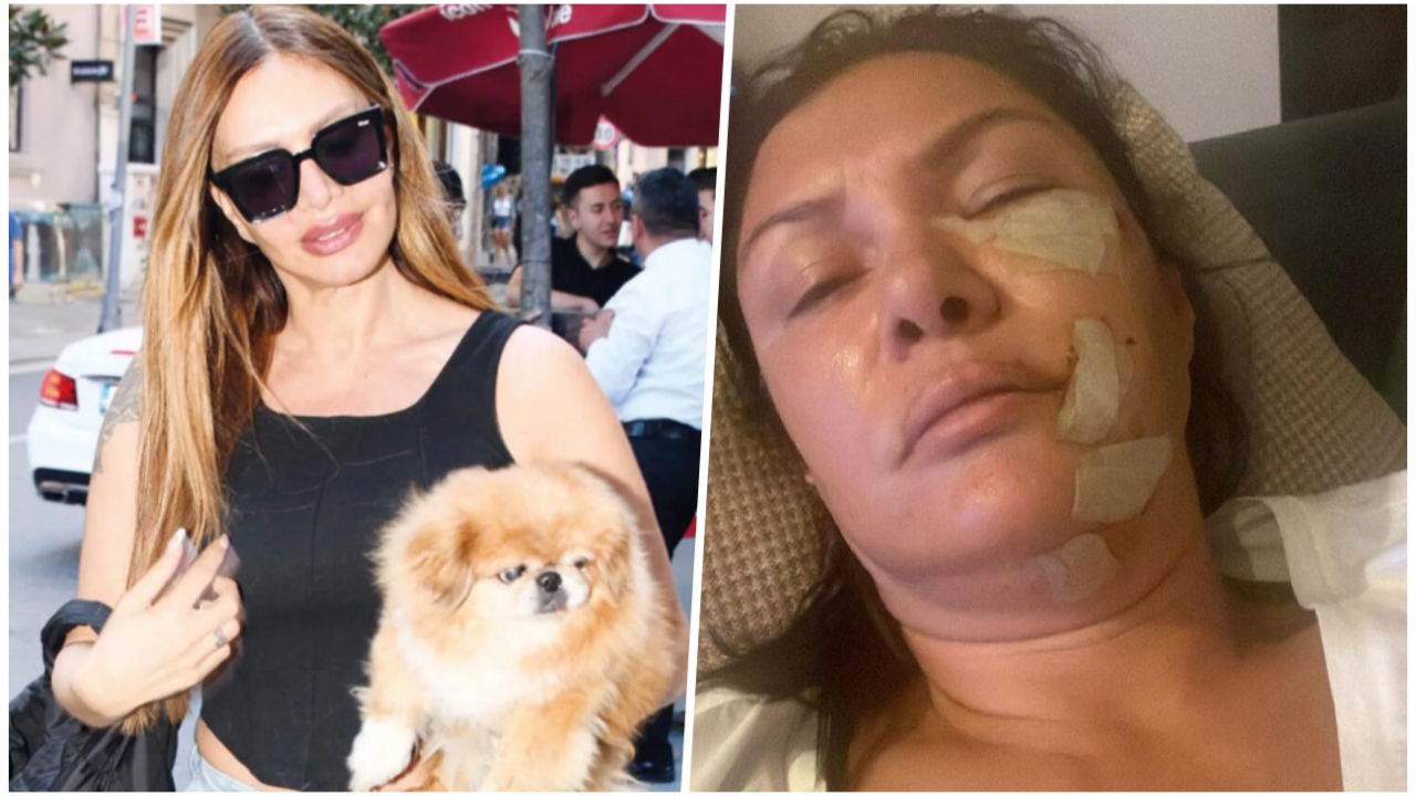 Sevda Demirel'den Tuğba Altıntop hakkında şaşırtan iddia: ''Yüzüne köpek saldırmadı''