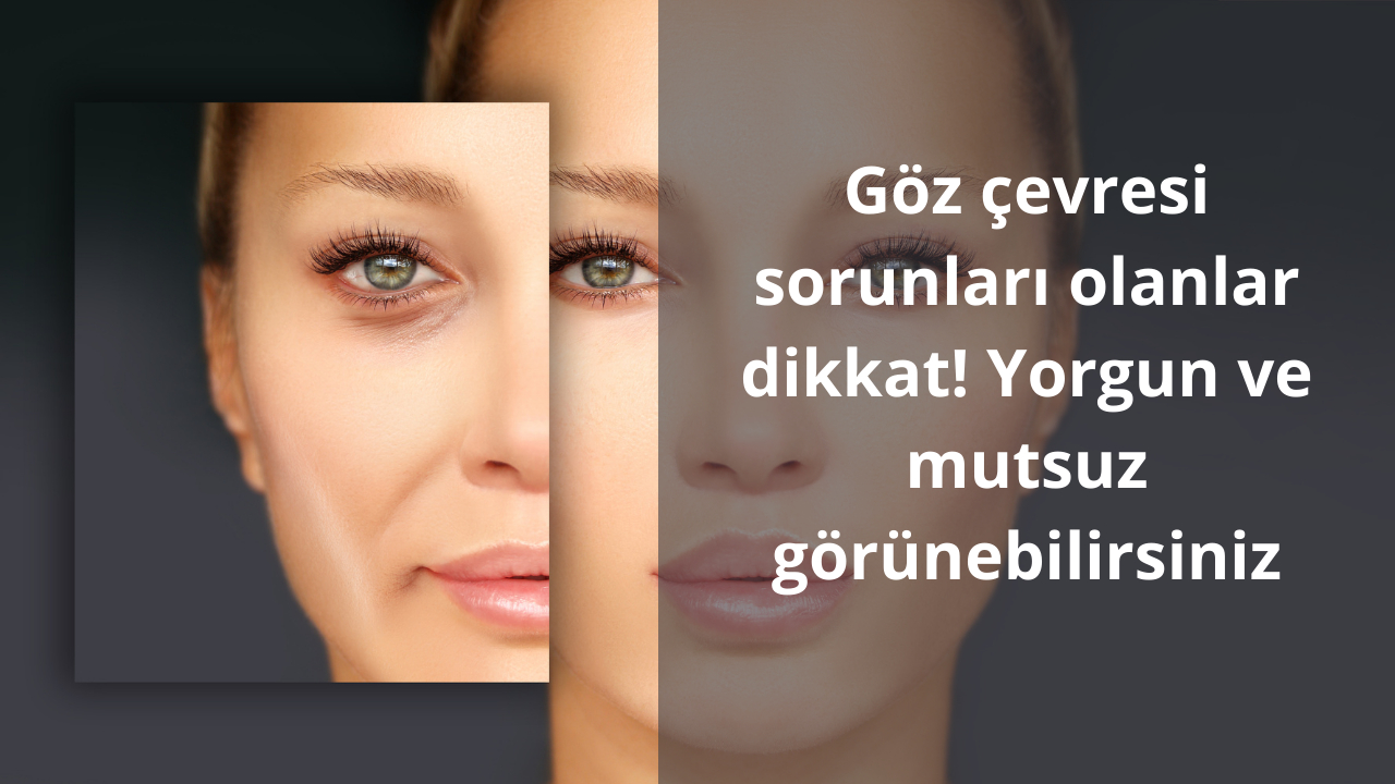 Göz çevresi sorunları olanlar dikkat! Yorgun ve mutsuz görünebilirsiniz