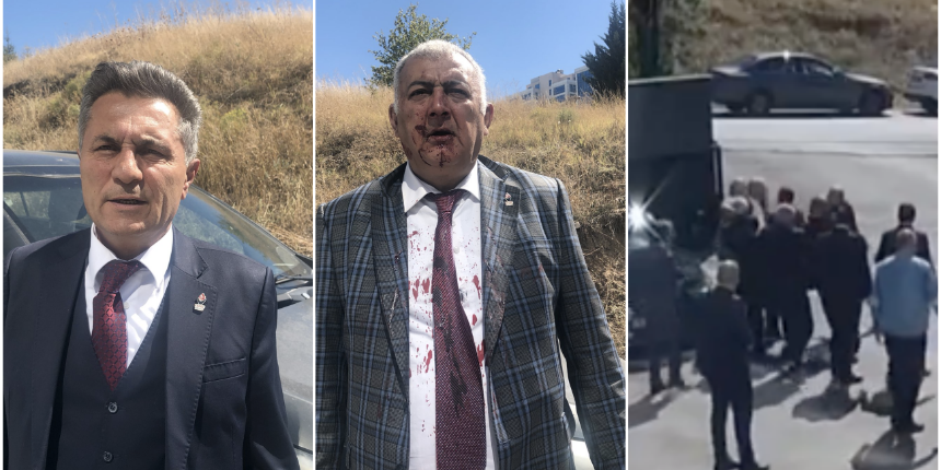 "Ümit Özdağ'ın talimatıyla darp edildim" diyerek istifa etmişti: Darp görüntüleri ortaya çıktı