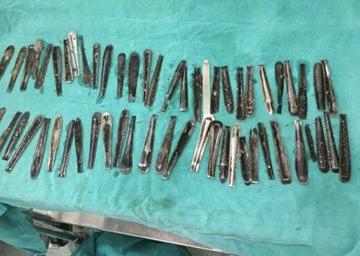 Karın ağrısı şikayetiyle hastaneye gitti, gerçek ortaya çıktı