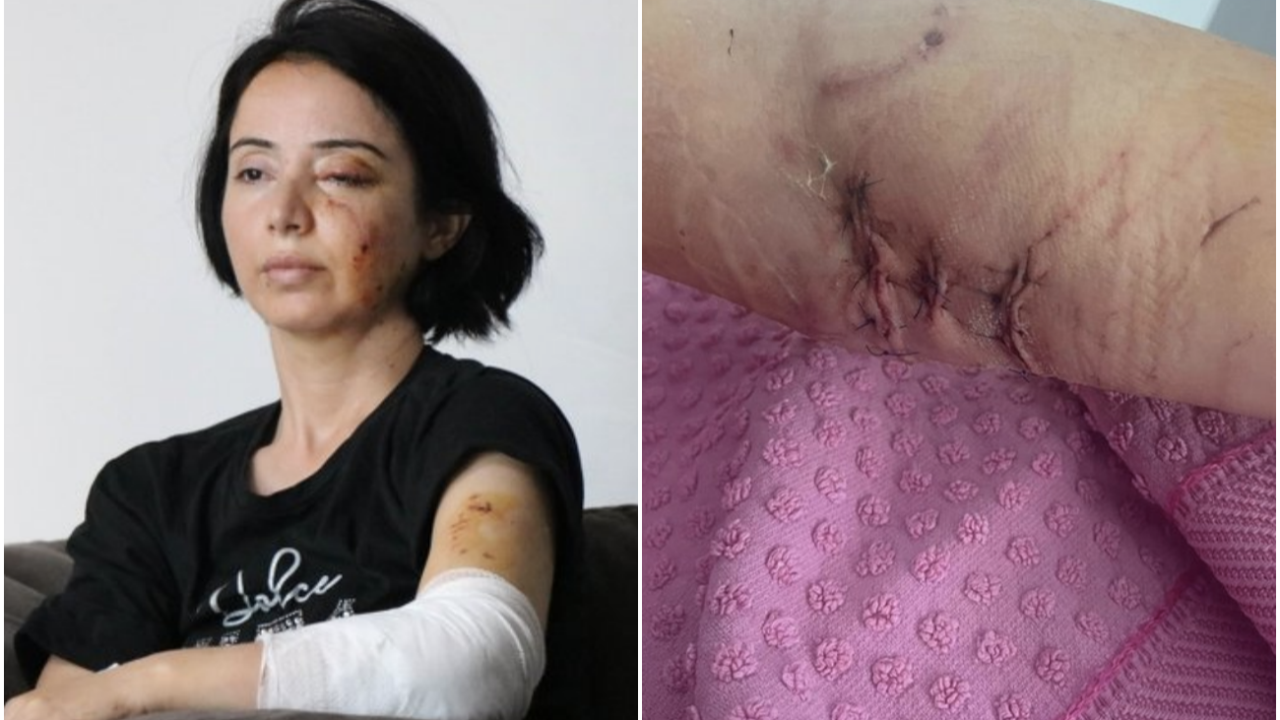 Samsun'da saldırgan köpek dehşeti!
