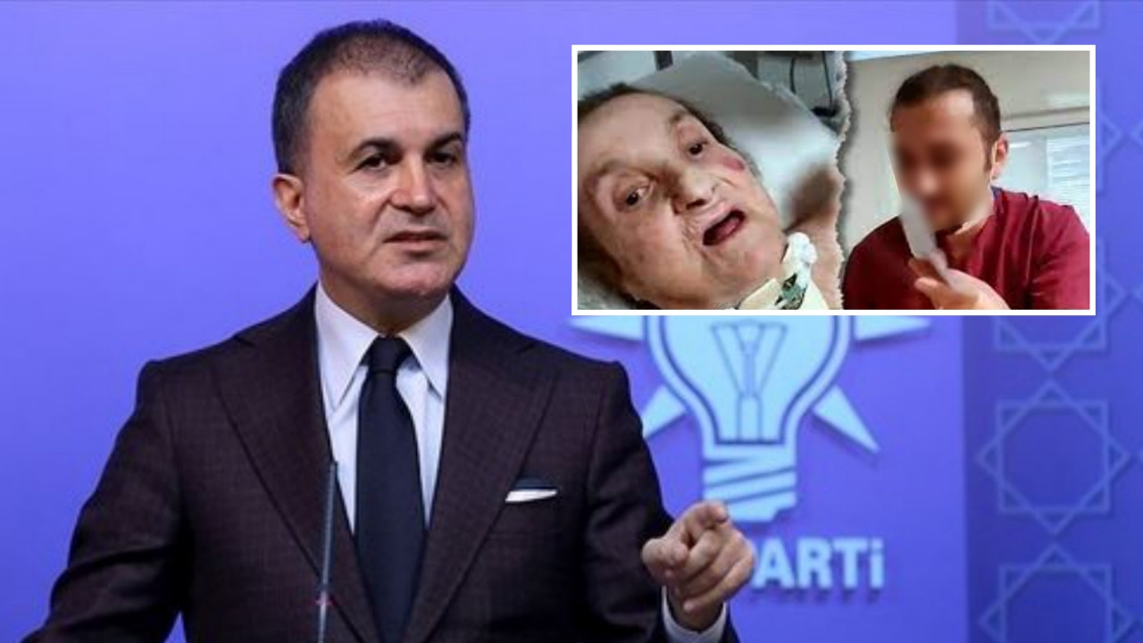 Özel Bayındır İçerenköy Hastanesi'ndeki skandala AK Parti'den tepki: Hukuki sürecin takipçisi olacağız