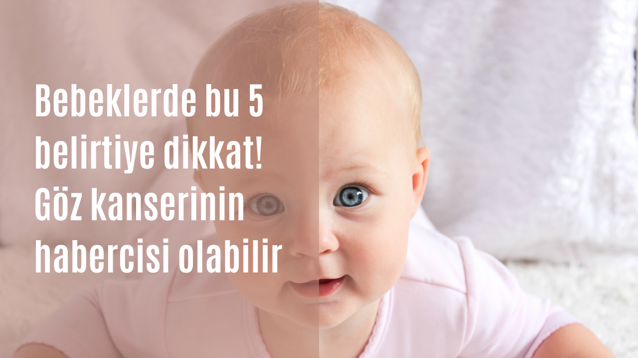 Bebeklerde bu 5 belirtiye dikkat! Göz kanserinin habercisi olabilir