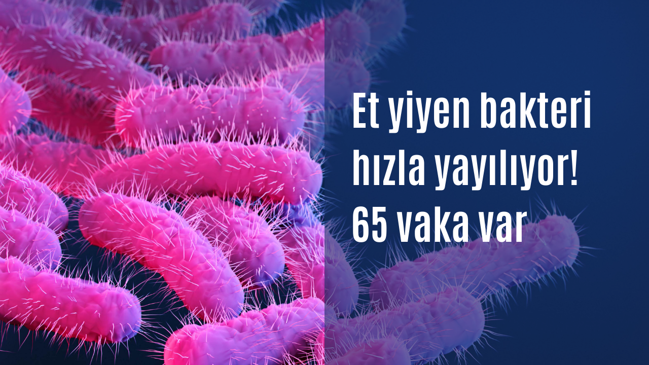 Et yiyen bakteri hızla yayılıyor! 65 vaka var