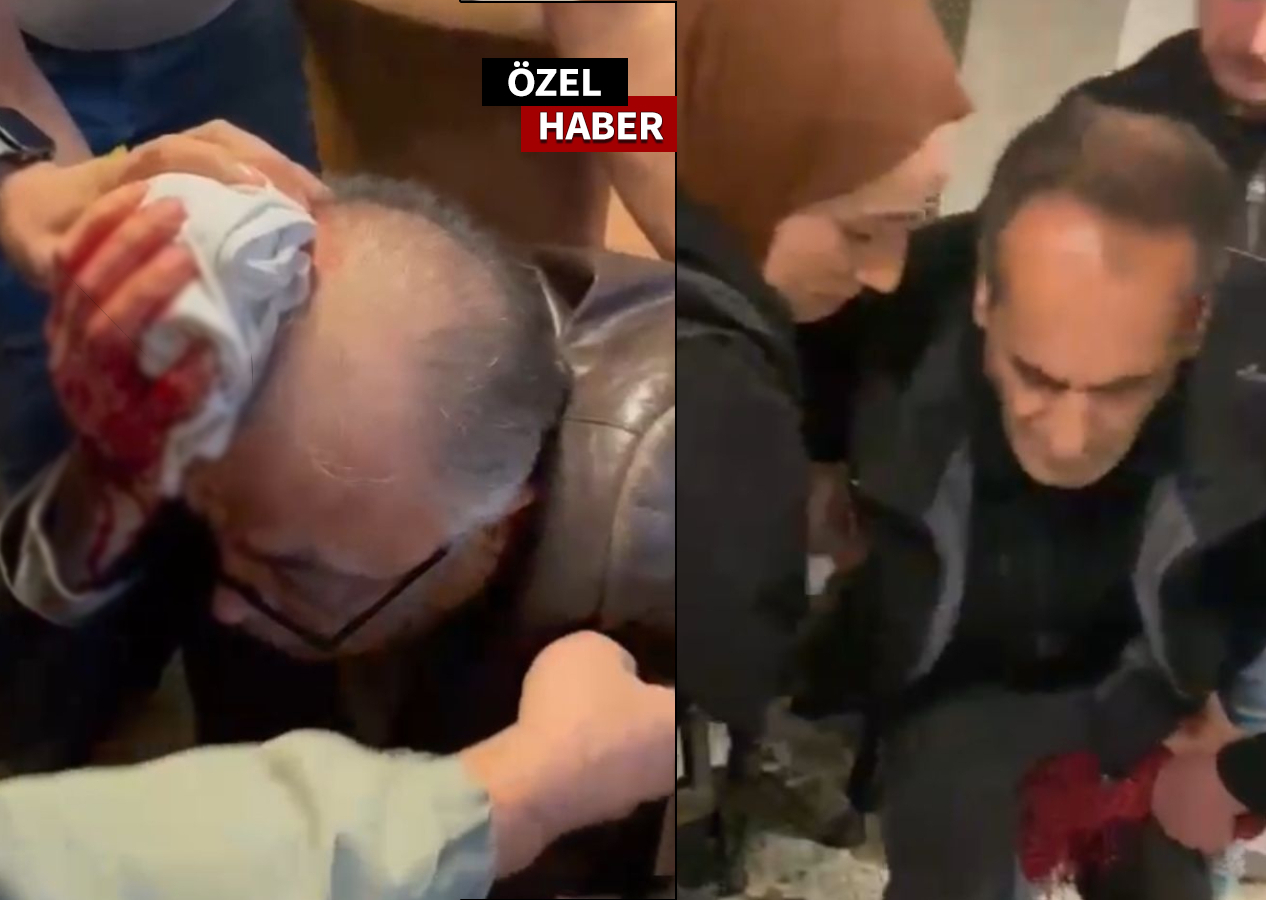 Silahlı çatışmada 2 mucize kurtuluş!
