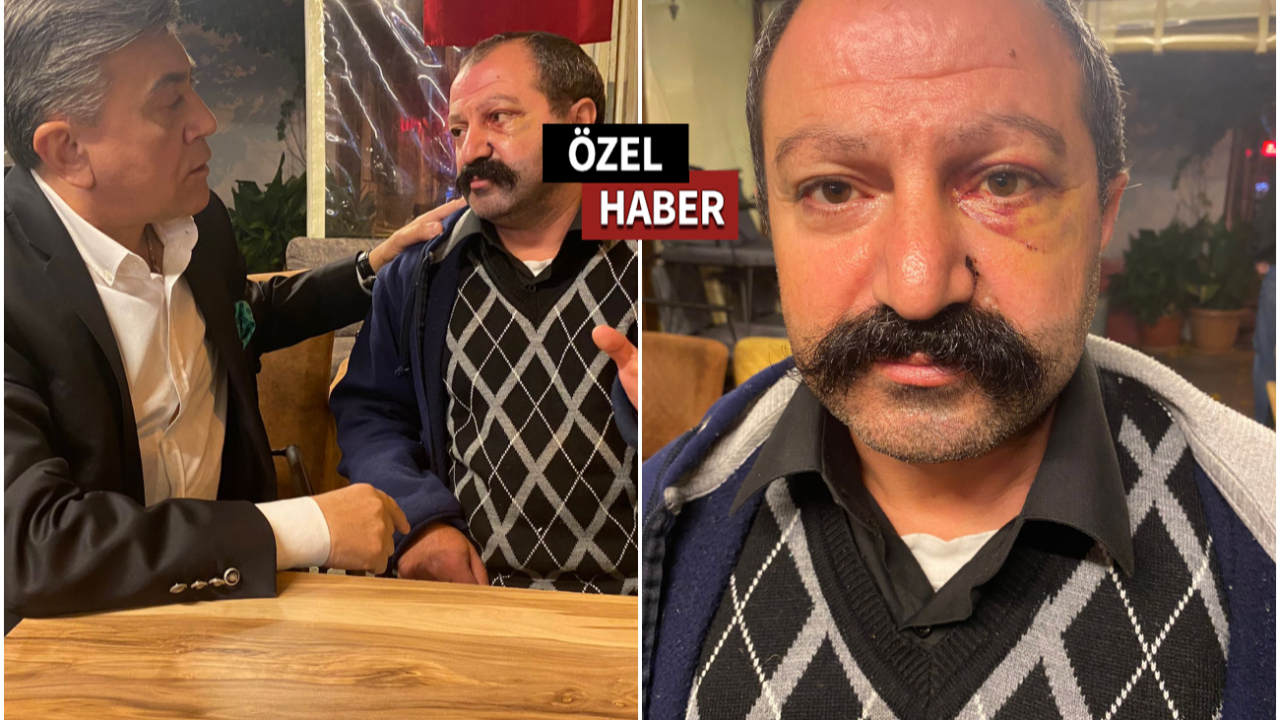 Kiracıyı döven saldırgan tutuklandı! Yemekteyiz şampiyonunun yüzünde kırık tespit edildi!