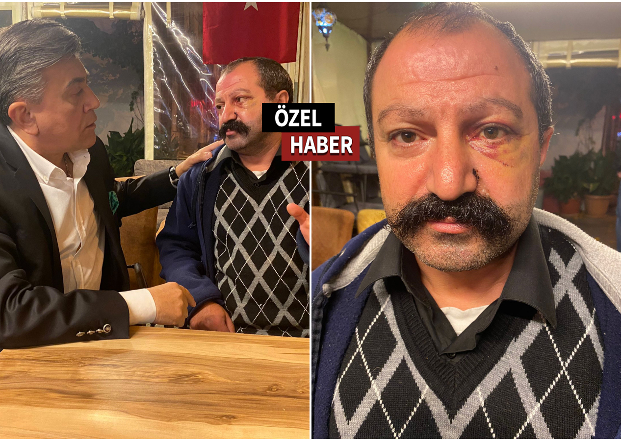 Kiracıyı döven saldırgan tutuklandı! Yemekteyiz şampiyonunun yüzünde kırık tespit edildi!