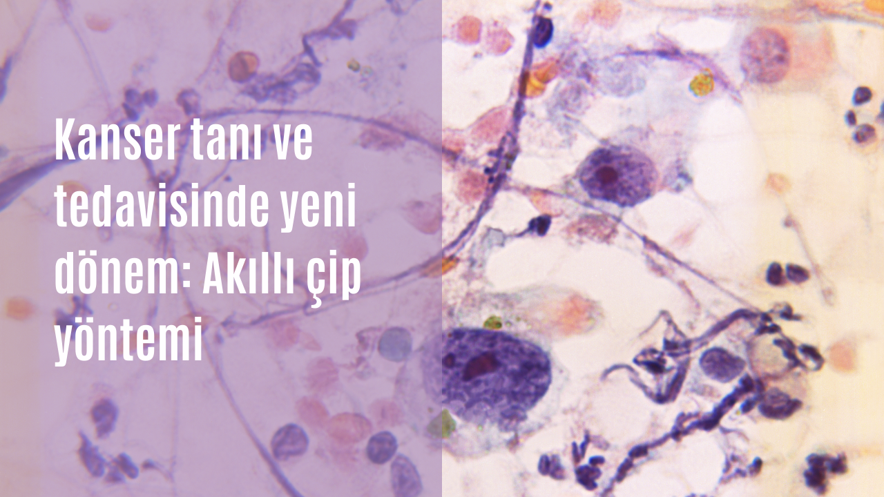 Kanser tanı ve tedavisinde yeni dönem: Akıllı çip yöntemi