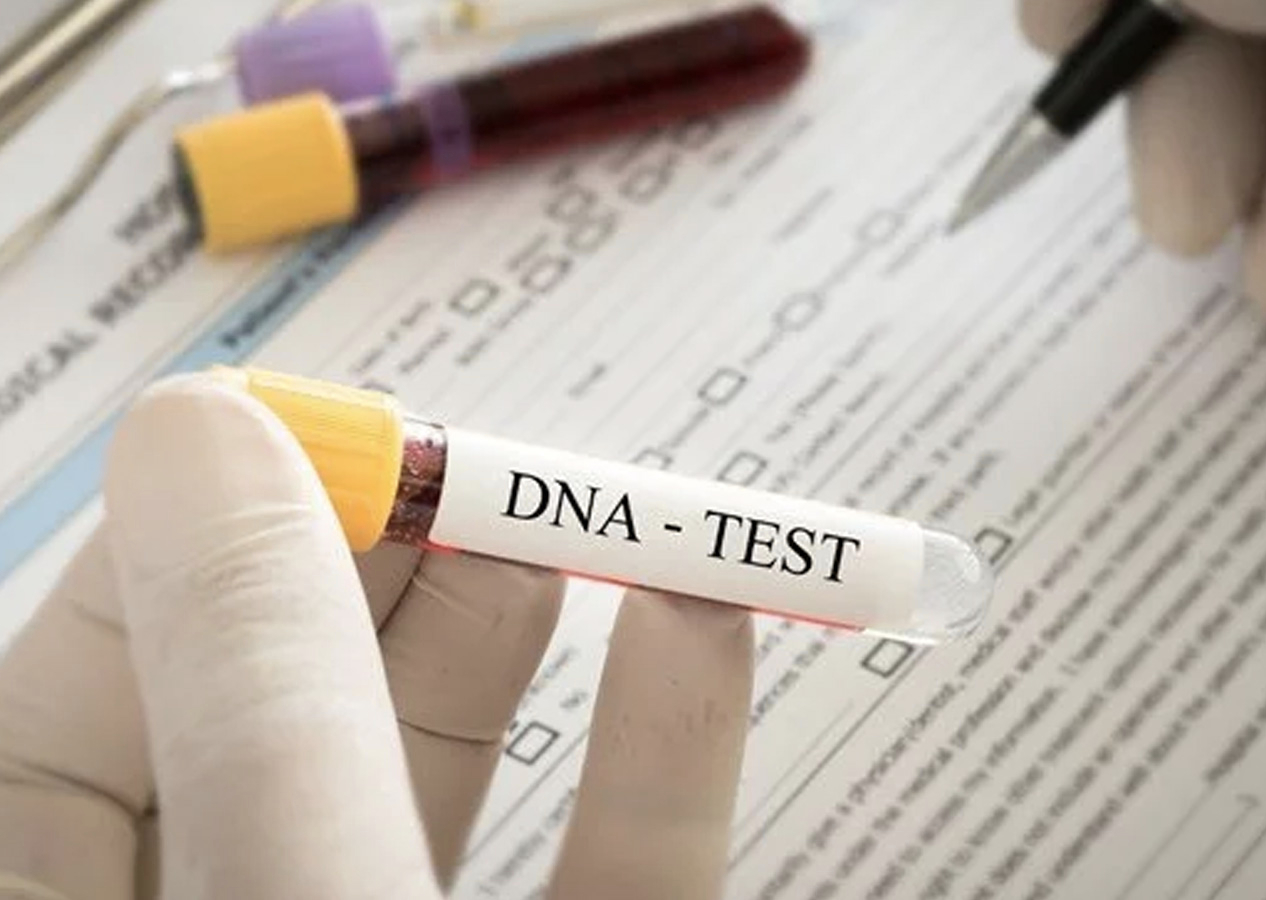 Bir DNA testi 186 milyon liralık mirasın önünü açtı