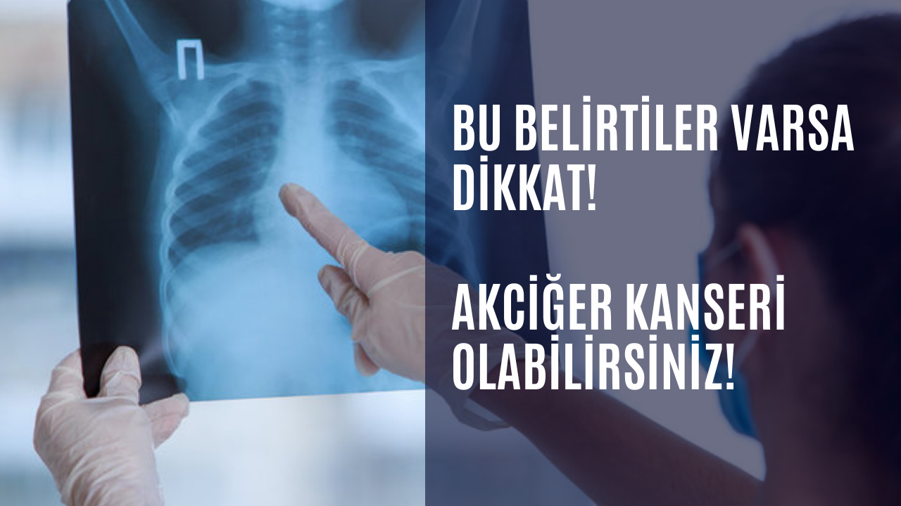 Bu belirtiler varsa dikkat! Akciğer kanseri olabilirsiniz!