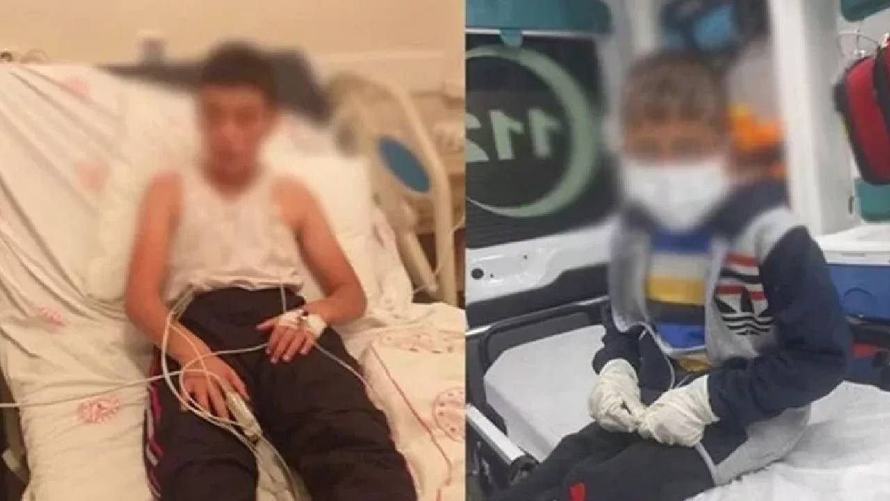 Kuduz vakasında flaş gelişme! Hastaneden açıklama geldi