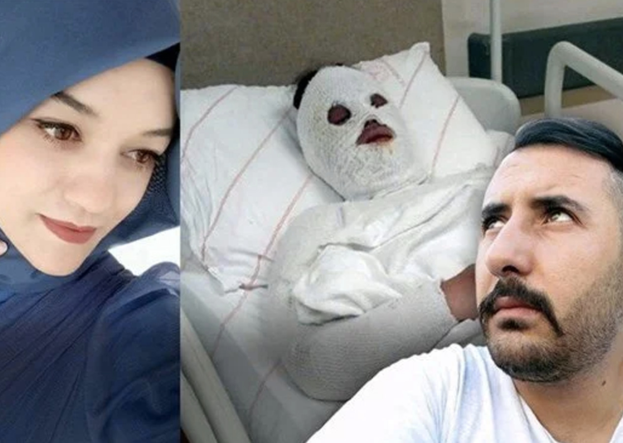 Eski nişanlısına kimyasal maddeyle saldırmıştı: Ağırlaştırılmış müebbet hapsi isteniyor