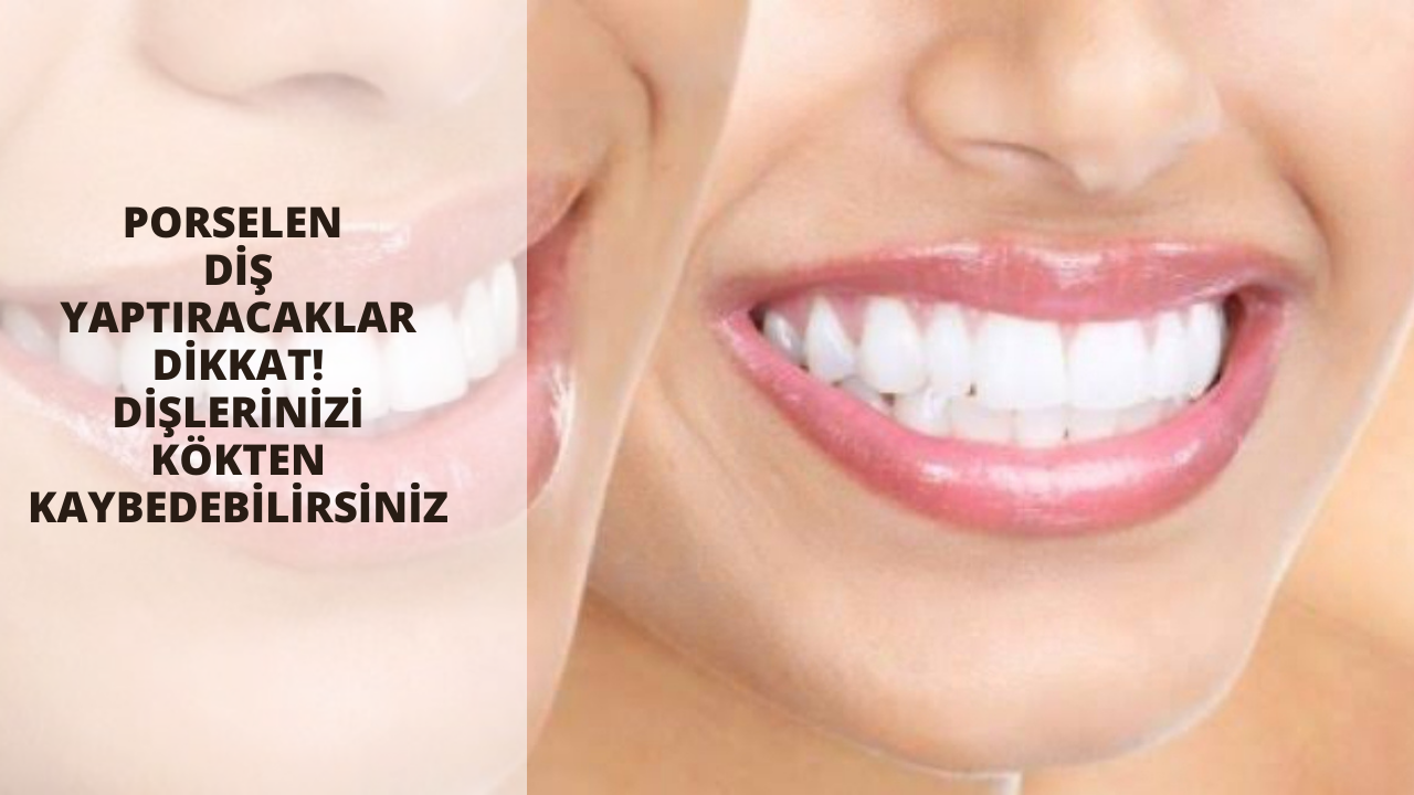 Porselen diş yaptıracaklar dikkat! Dişlerinizi kökten kaybedebilirsiniz