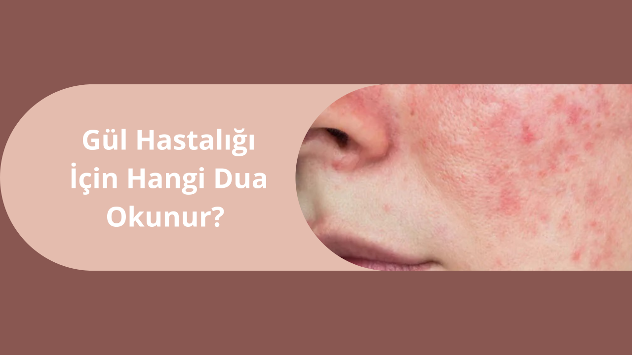Gül Hastalığı İçin Hangi Dua Okunur?