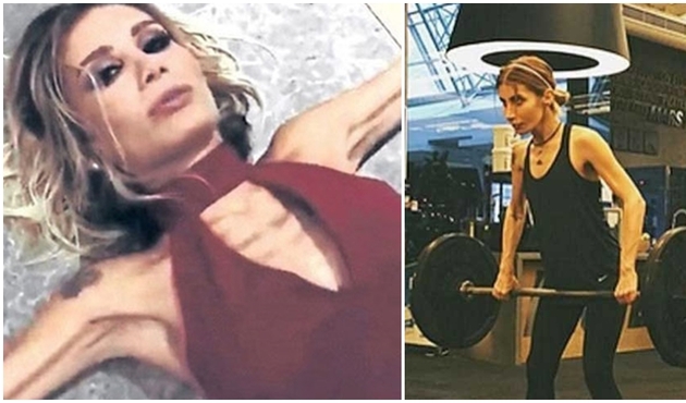 Şok iddia... İrem Derici bir deri bir kemik kaldı, tedaviye başladı!