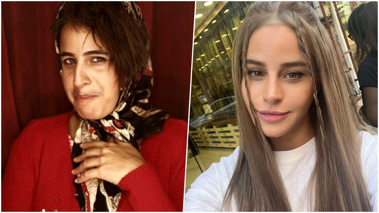Güzelleşmek uğruna ameliyat masasına yattı... Değişimiyle şoke eden Büşra Pekin'in estetik operasyonlara ödediği ücret ortaya çıktı