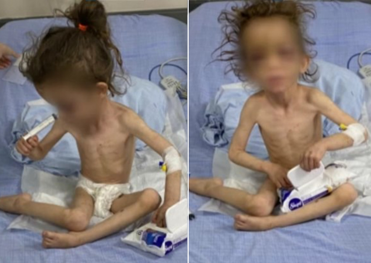 Gaziantep'te cani anne 5 yaşındaki çocuğuna günlerce işkence yaptı! Bakan Yanık'tan son dakika açıklaması...