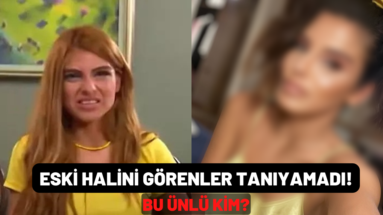 Bircan Bali'nin estetiksiz halini görenler tanımadı! Estetik iddialarını redetti!