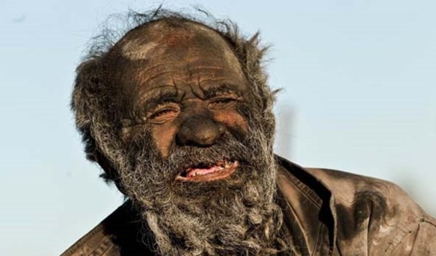 Garip ama gerçek! 60 yıldır yıkanmayan adam...