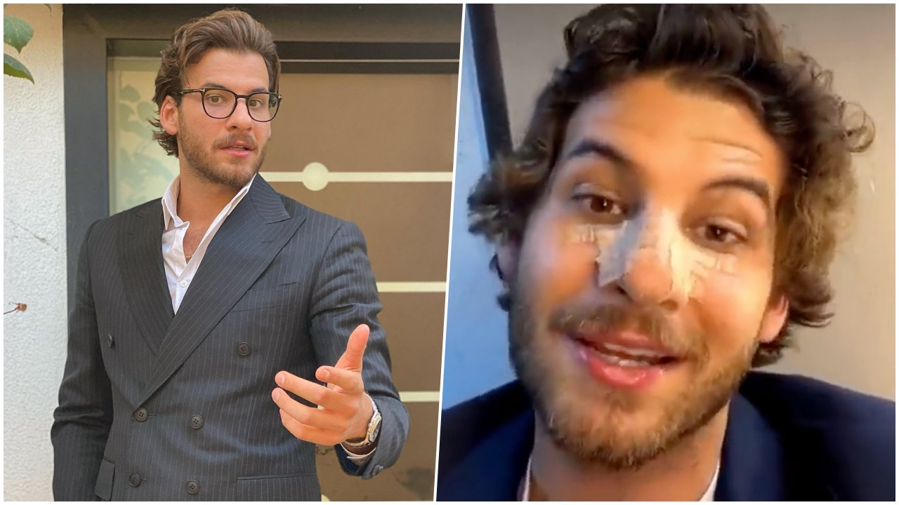 Sette talihsiz kaza! Mustafa Mert Koç'un burnu kırıldı