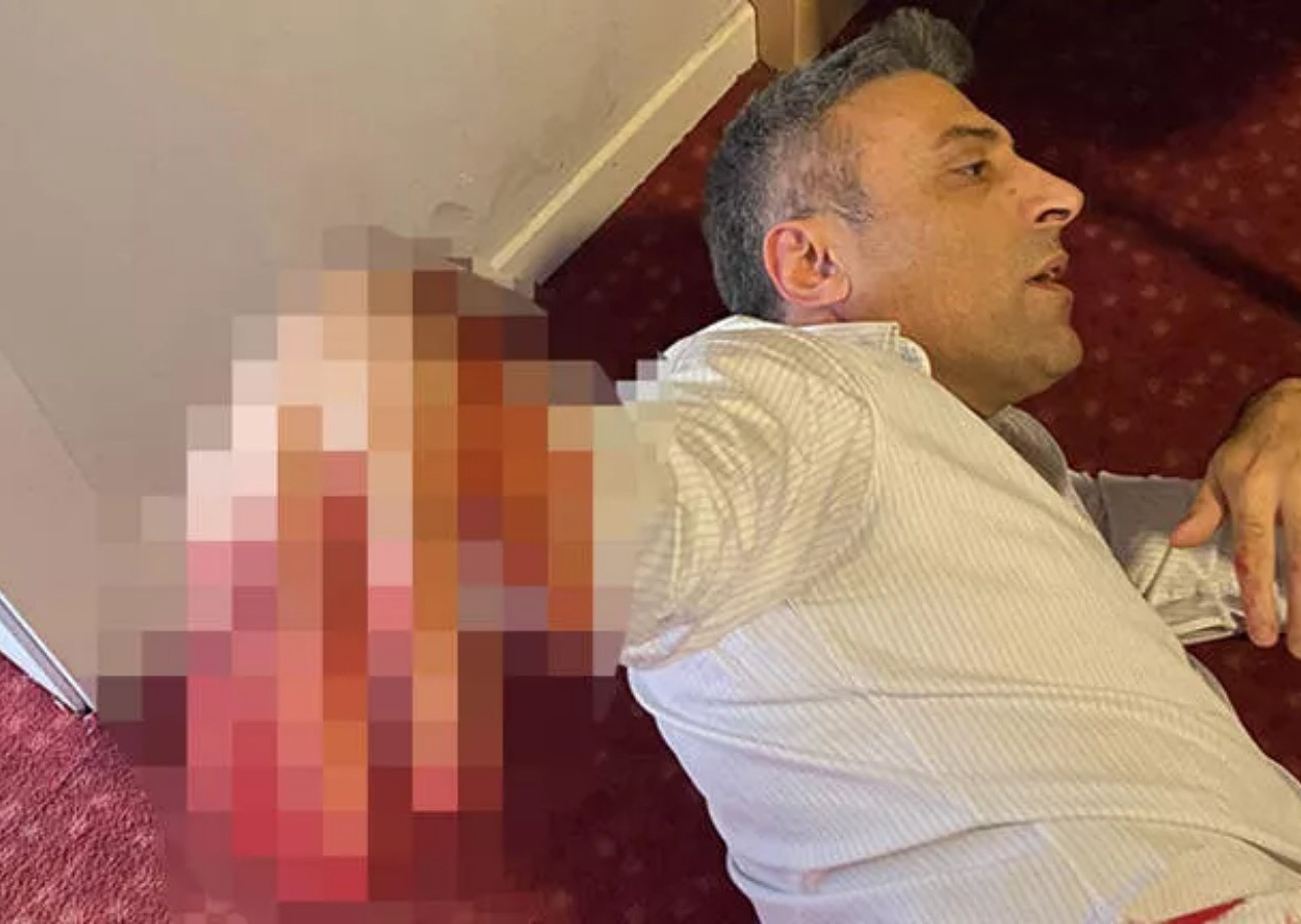 Yenilik Partisi lideri Öztürk Yılmaz'a bıçaklı saldırı