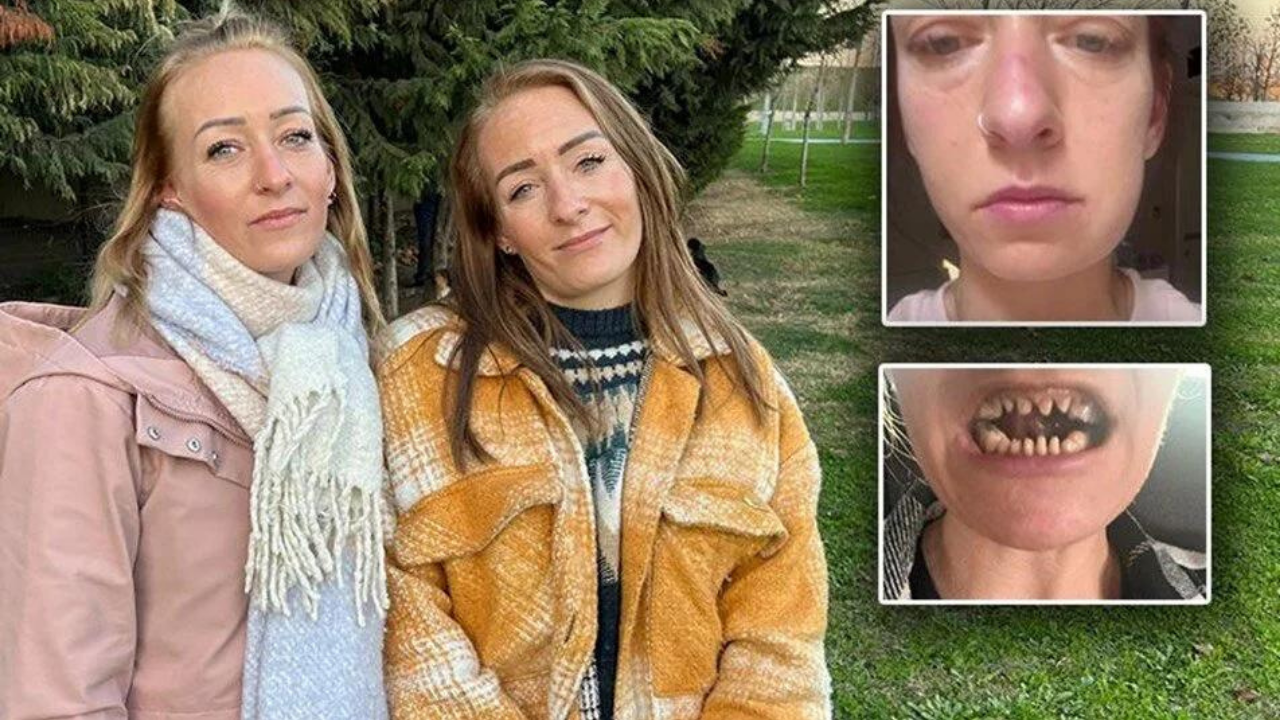 İkizlerin dişleri için geldiği klinik hayatlarının kabusu oldu!