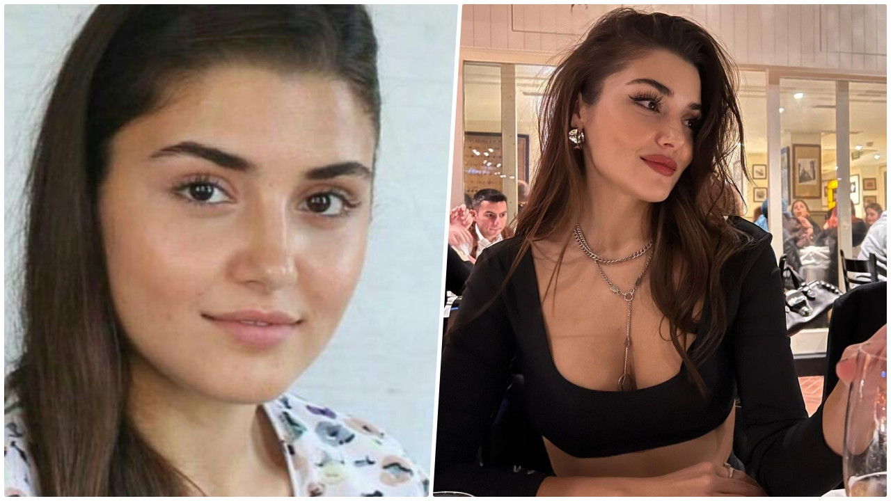 Bakıma giren Hande Erçel ameliyatsız operasyonlarla güzelleşti