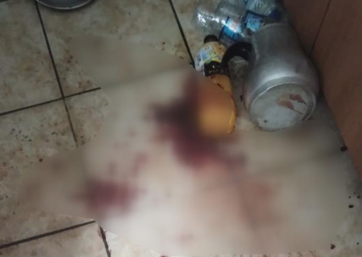 ‘Araba’ uğruna amcasının kafa derisini yüzdü