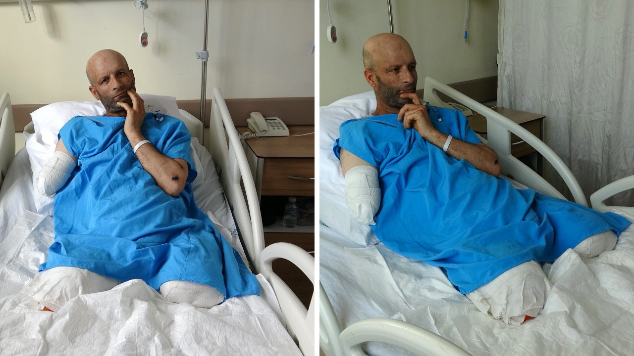 3 gün sonunda yanlışlıkla bulundu! 2 bacağını 1 kolunu kaybetti...