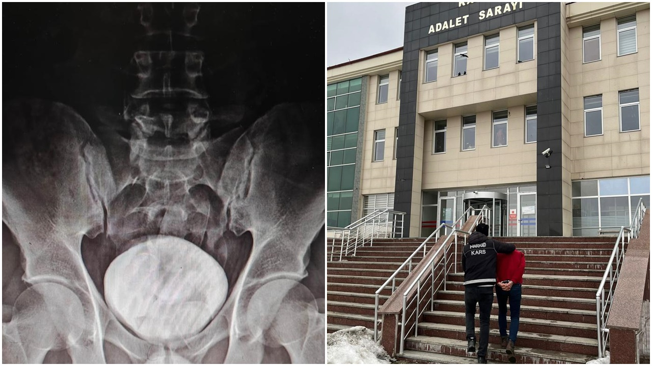 Çekildiği röntgende yakayı ele verdi! Makatına uyuşturucu saklayan şüpheli tutuklandı