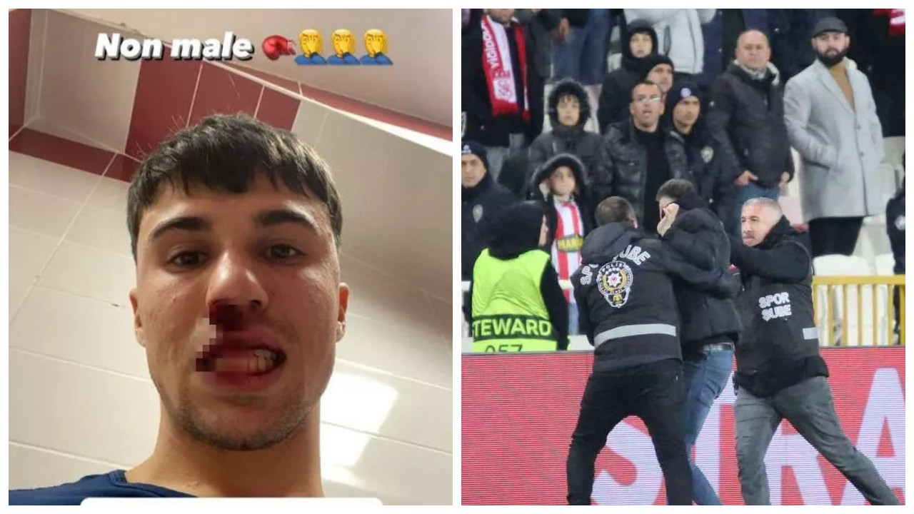 Sivas'ta İtalyan futbolcuya saldırı! Burnu kırıldı...