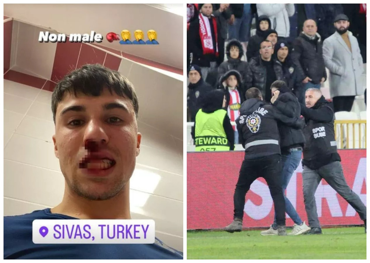 Sivas'ta İtalyan futbolcuya saldırı! Burnu kırıldı...