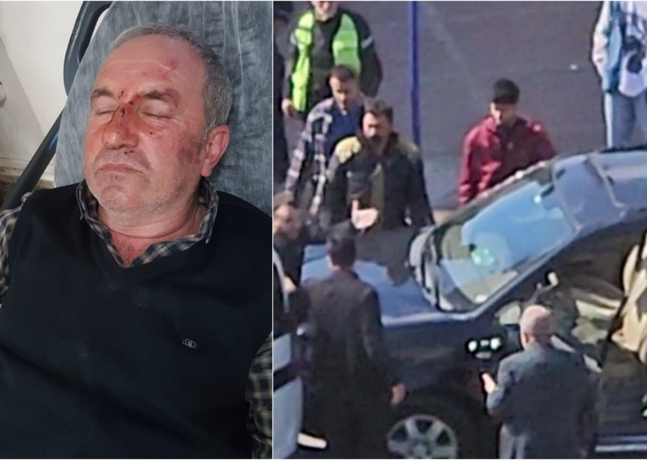 Kulak zarı patlayana kadar dövdüler: 'Bu değilmiş' deyip kaçtılar