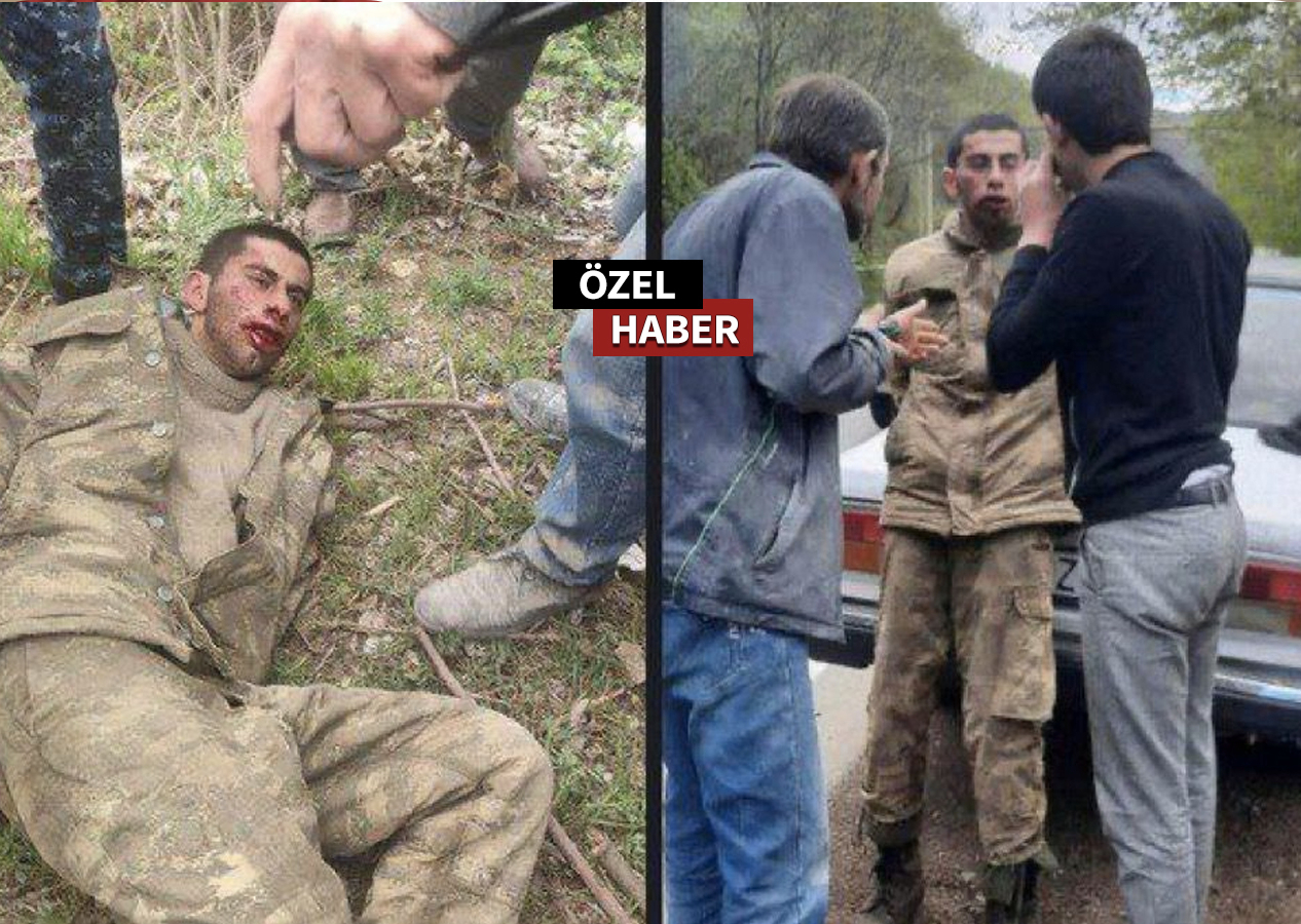 İşte Ermeni zulmü! Azerbaycan askerine böyle işkence yaptılar!