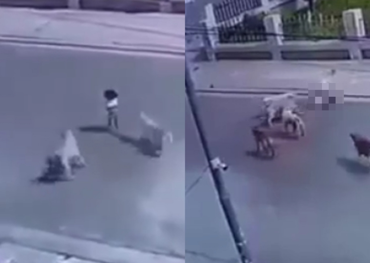 Korkunç görüntüler: Sokak köpekleri küçük kıza saldırdı! Durumu kritik