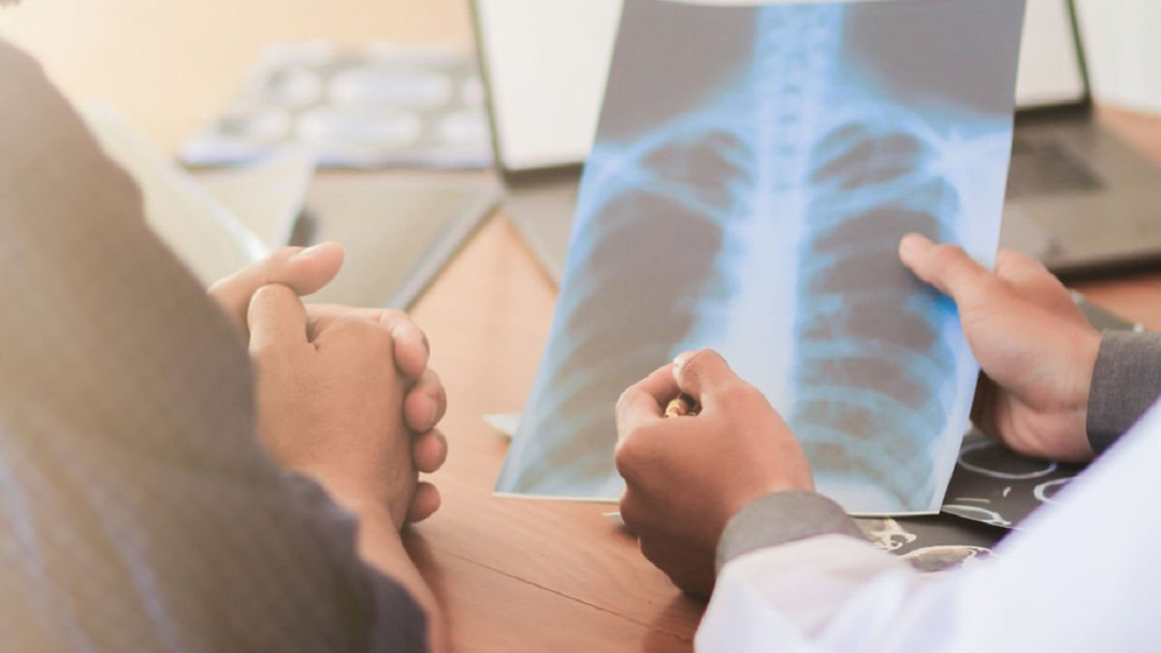 Akciğer kanseri riskini öğrenmek bu kadar kolay: Sadece parmak testiyle risk ortaya çıkıyor! Parmak testi için…