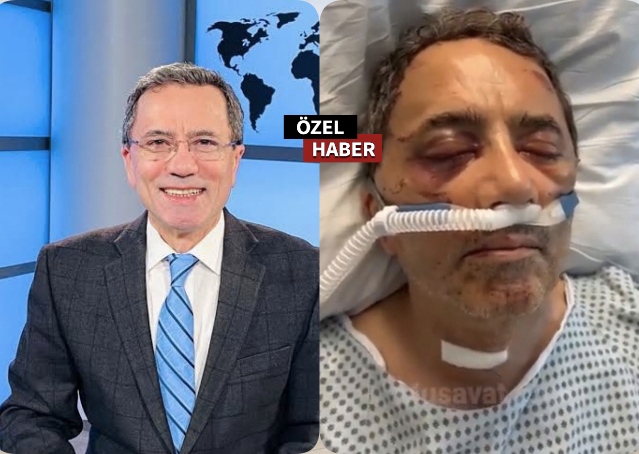 Amerika’da Türk gazeteciye saldırı! Muhalif gazeteci ve oğlu ağır yaralandı!