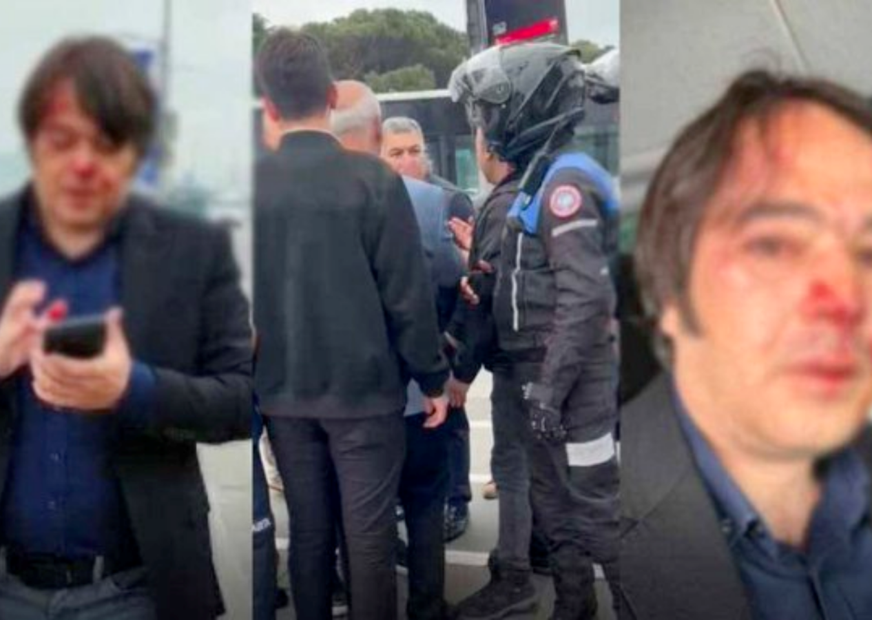 Üsküdar'da kaçak kafe yıkımında olay: İBB İmar Müdürü ve iki zabıta dövüldü