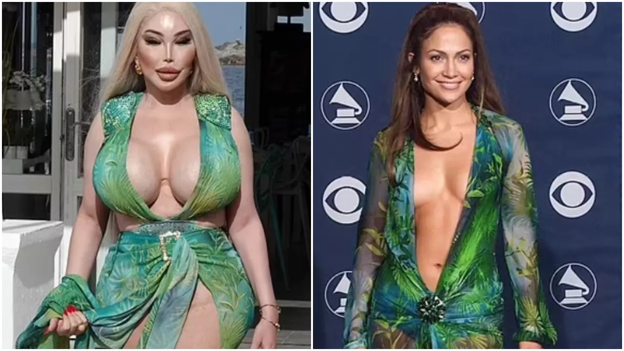 Jennifer Lopez'e benzemek için 100 ameliyat geçiren Jessica Alves hüsrana uğradı