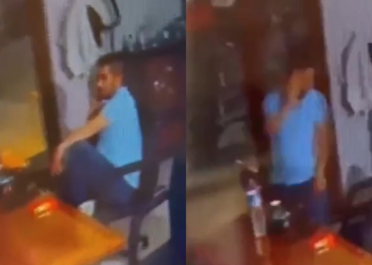 Ölümün kıyısından döndü! TV izlerken kurşun kafasını böyle sıyırdı