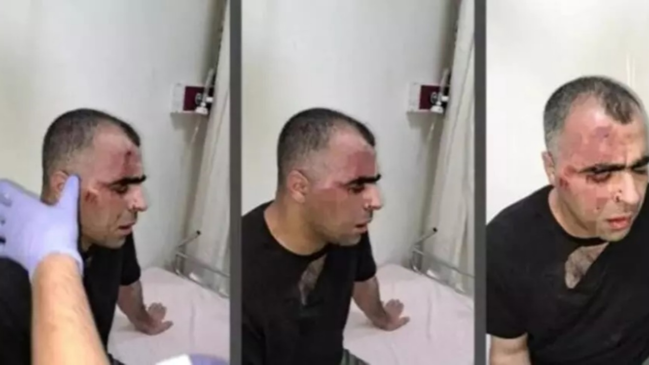 Bitlis'te gazeteci Sinan Aygül'ü darp eden belediye çalışanı ve polis memuru tutuklandı