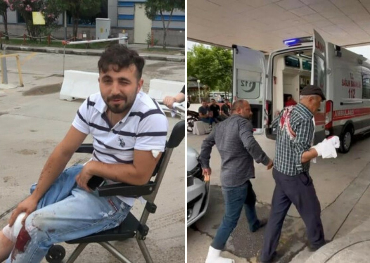 Acemi kasaplar bu bayram da ortaya çıktı! Kimi elini kimi bacağını kesti...
