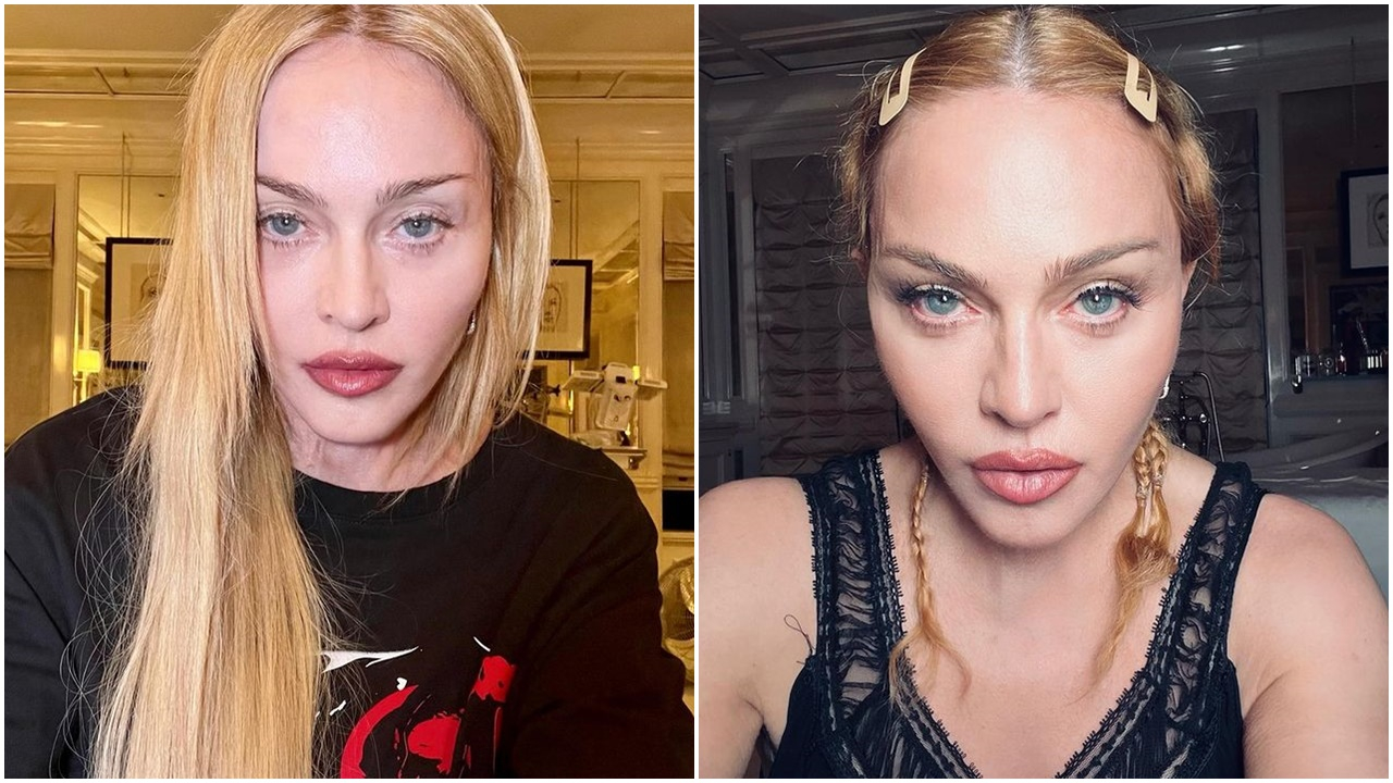 Yoğun bakımda tedavi görüyordu! Taburcu edilen Madonna'dan ilk açıklama: Uyandığımda ilk aklıma gelen şey...