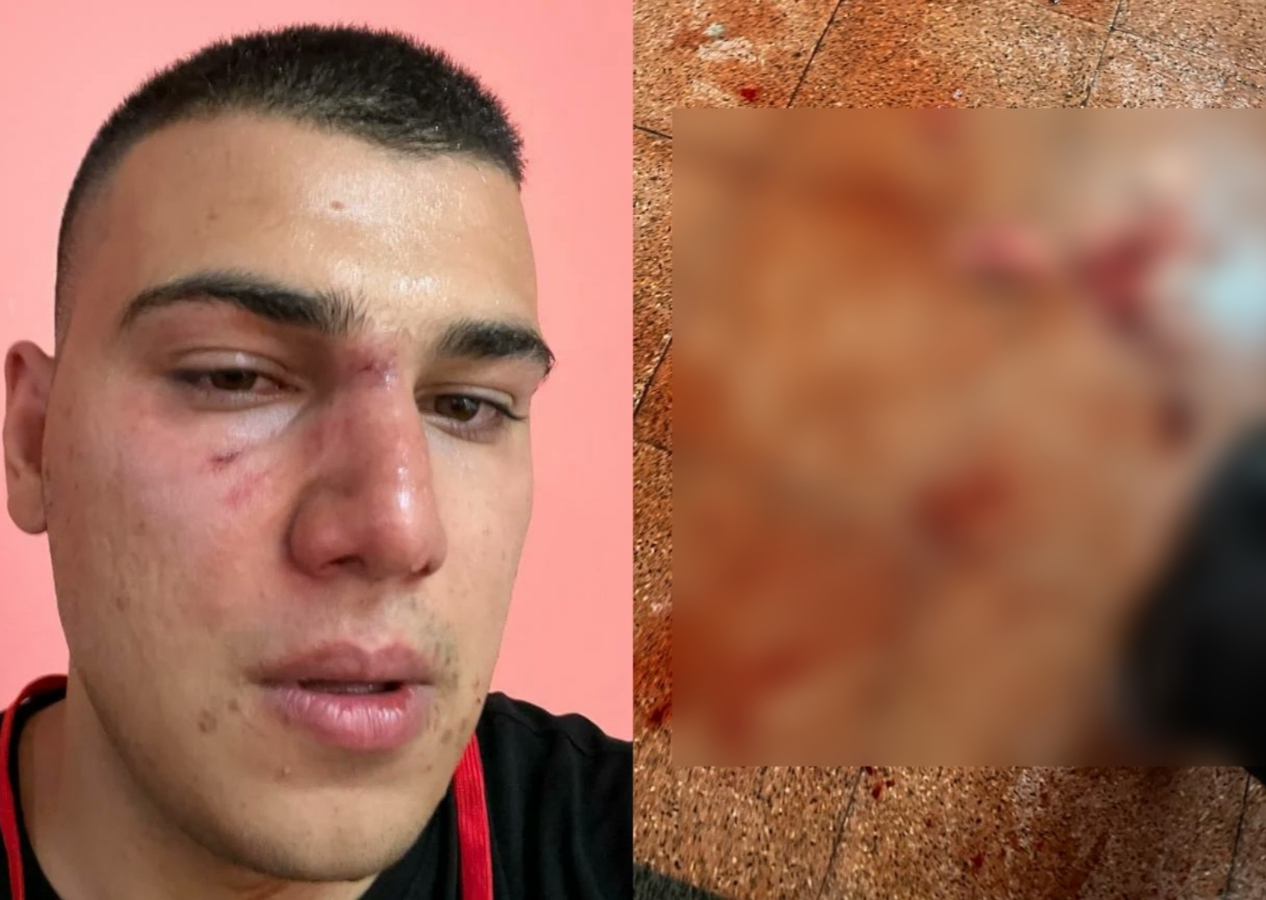 CHP'de 'değişim' isteyenin ağzını burnunu kırıyorlar! Gençlere saldırdılar...