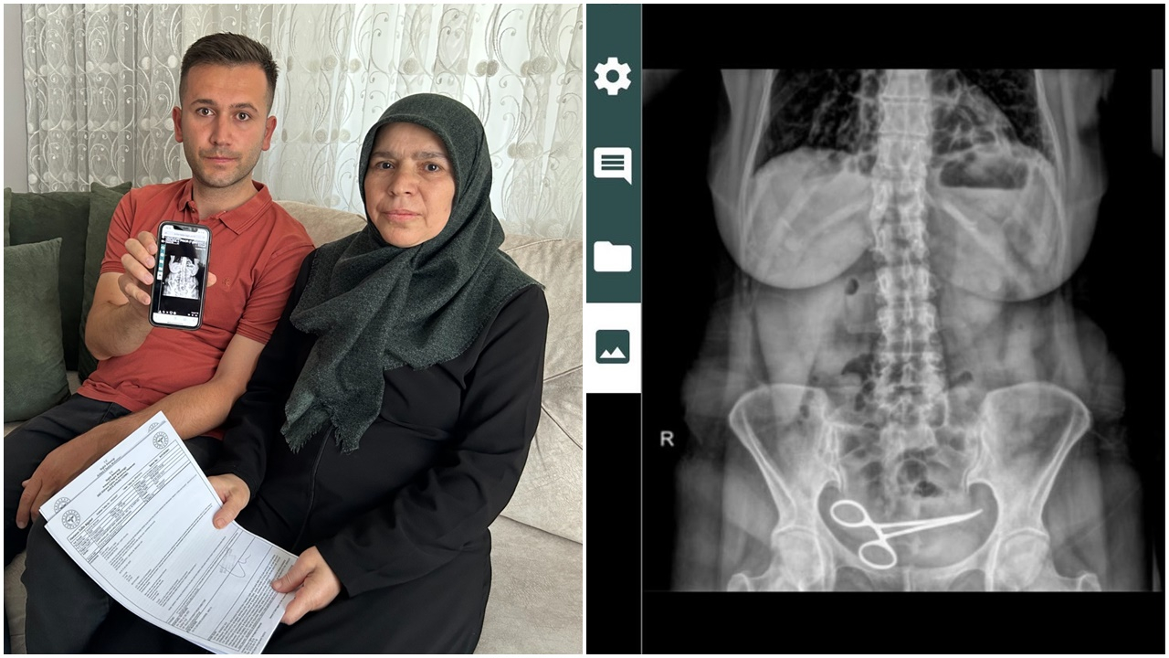 Ameliyat olan kadının karnında makas unuttular! Üstüne birde gerçeği ondan gizlediler