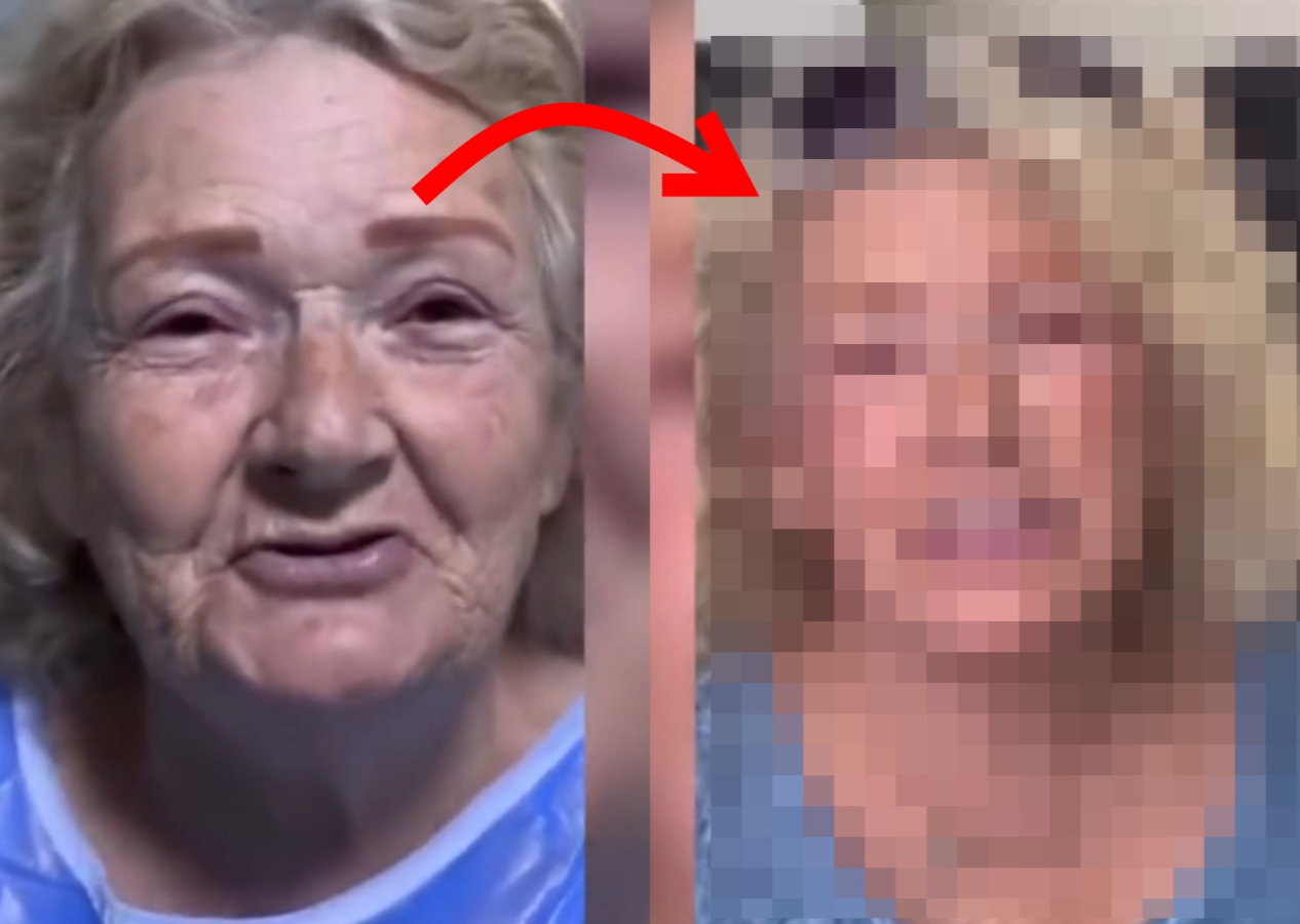 Yaşlı bir kadının estetik sonrası değişimi gündem oldu! Görenler inanmakta güçlük çekti