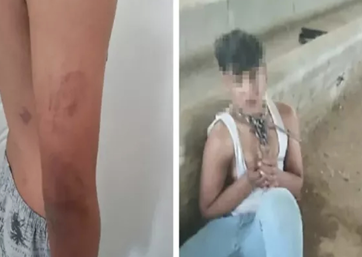 Çocuğu zincirle ahıra bağlayıp işkence yapan baba ve amca hakkında yeni gelişme