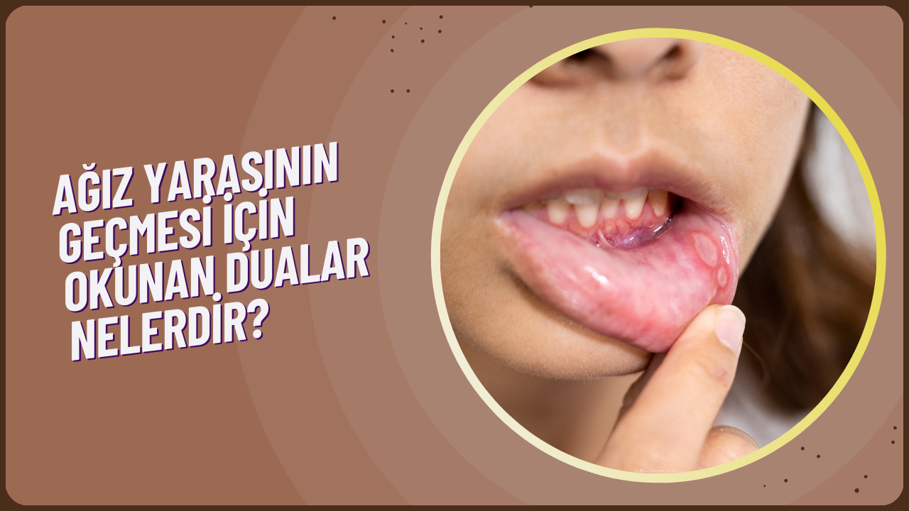 Ağız yarasının geçmesi için okunan şifa duaları nelerdir?