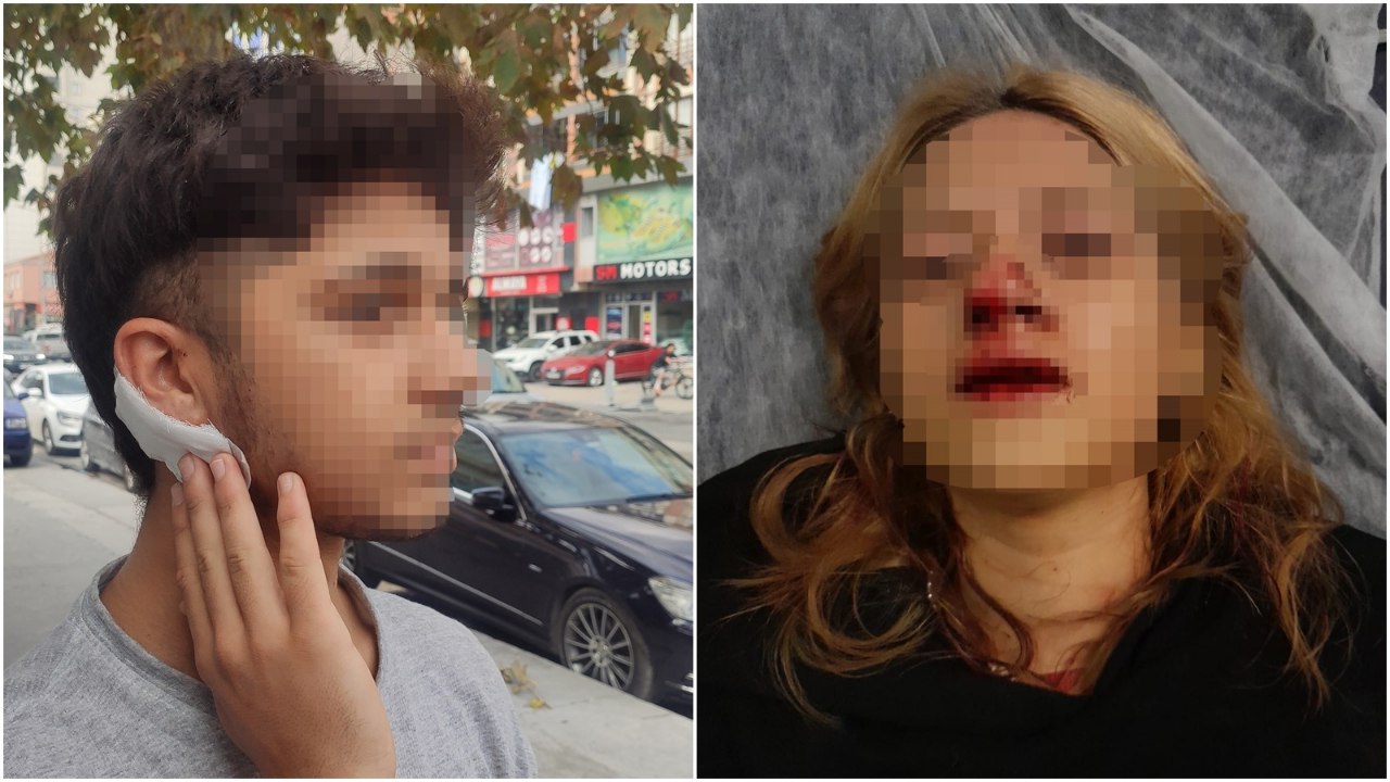 Bir grup saldırgan parkta oturan gençlere dehşet dolu anlar yaşattı: Talihsiz kızın yüzüne kaldırım taşı atarak dişlerini kırdılar! Erkek arkadaşının kulağını kestiler